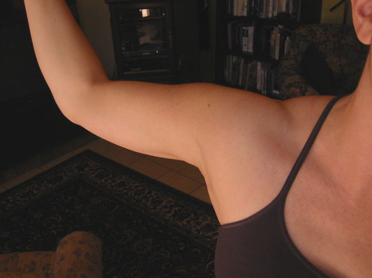 arm.JPG